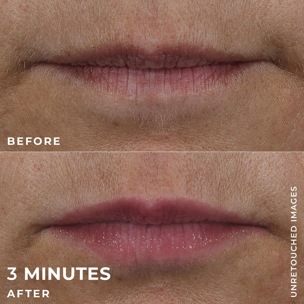 DERM CORREXION® Lip Volumizer