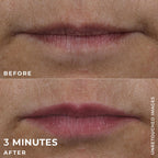 DERM CORREXION® Lip Volumizer
