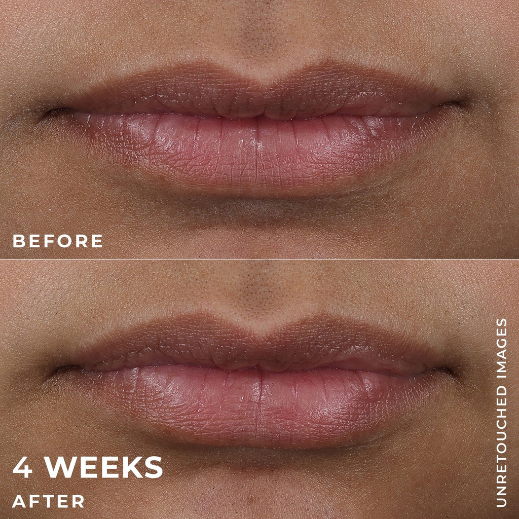 DERM CORREXION® Lip Volumizer