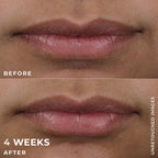DERM CORREXION® Lip Volumizer