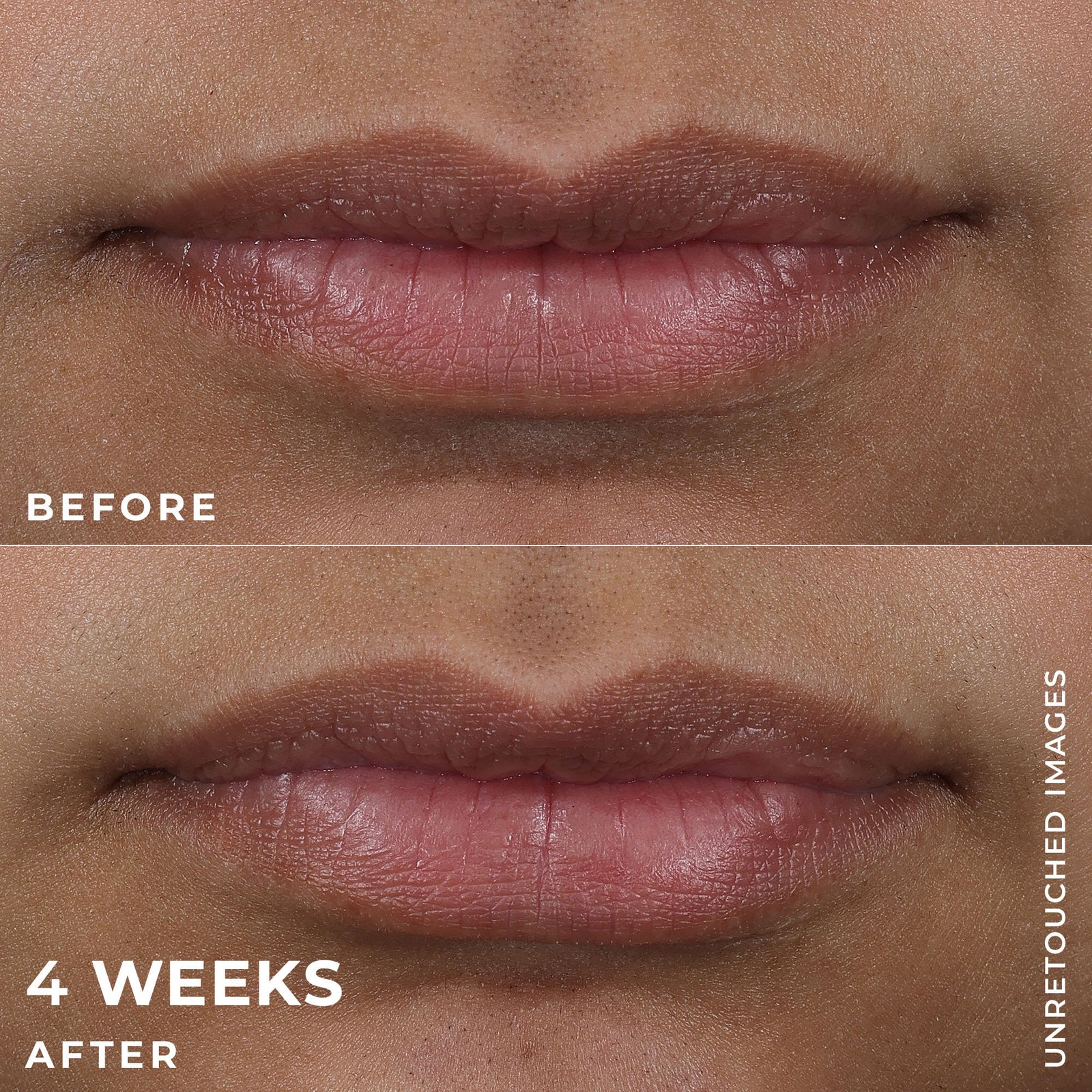 DERM CORREXION® Lip Volumizer