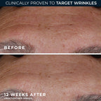 RETINOL CORREXION® Deep Wrinkle Serum 2PC