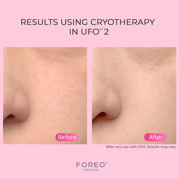 FOREO UFO™ 2 with 7pc day mask and 7pc night mask