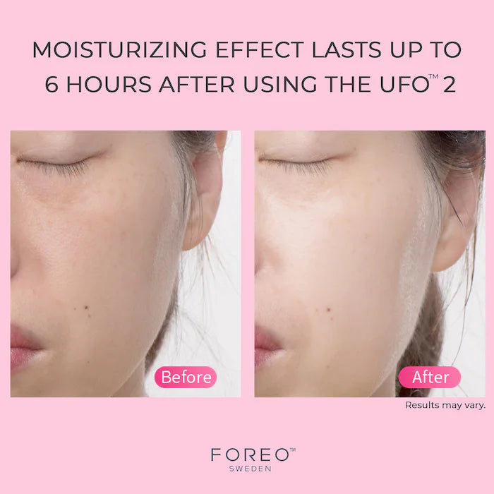 FOREO UFO™ 2 with 7pc day mask and 7pc night mask